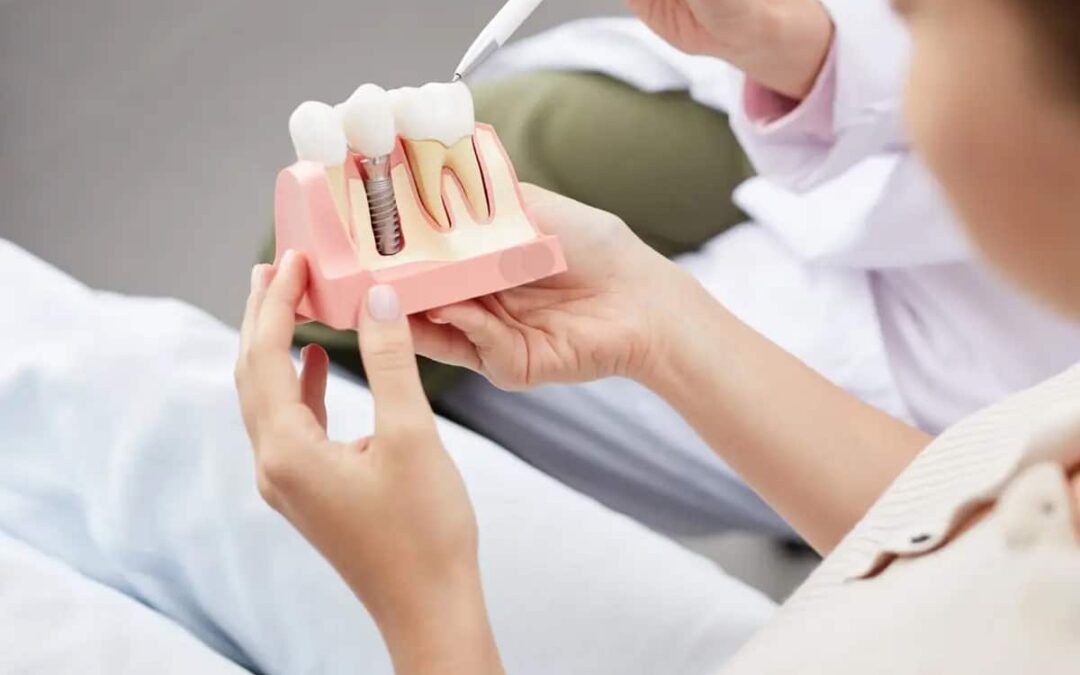 Ensayos Clínicos de Implantes Dentales: Cuidado Integral y Esperanza para Nuestras Sonrisas