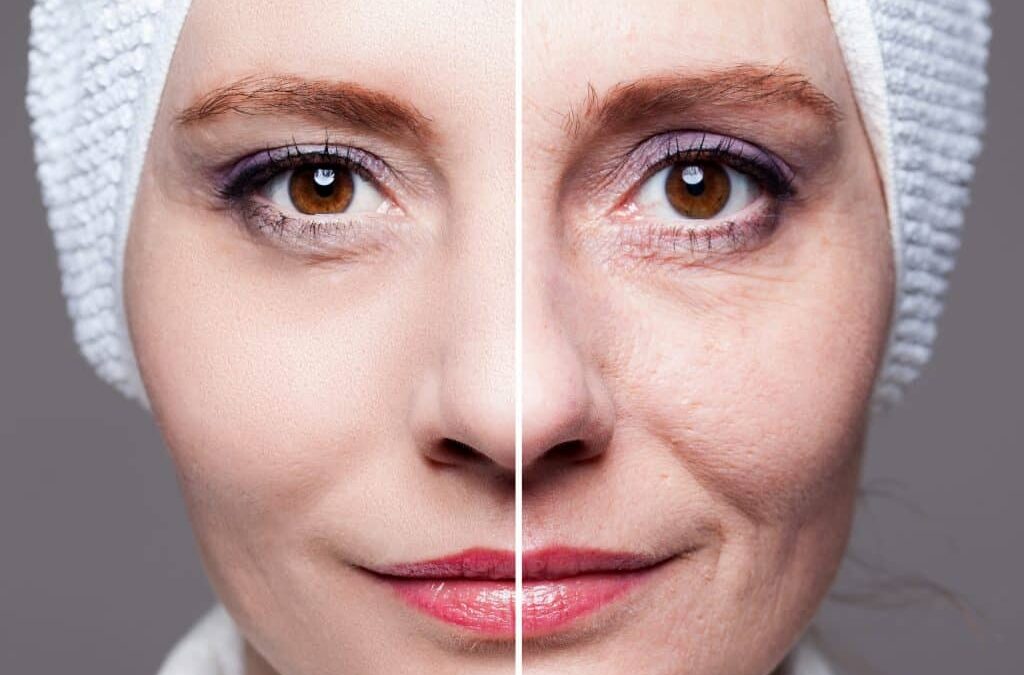 Cómo Encontrar Ofertas en el Rejuvenecimiento Cutáneo con Láser