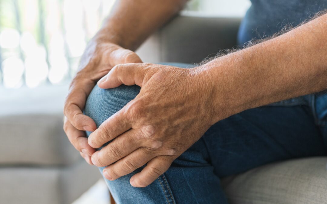 Arthritis Stem Cell Clinical Trials: What They Are and How to Participate